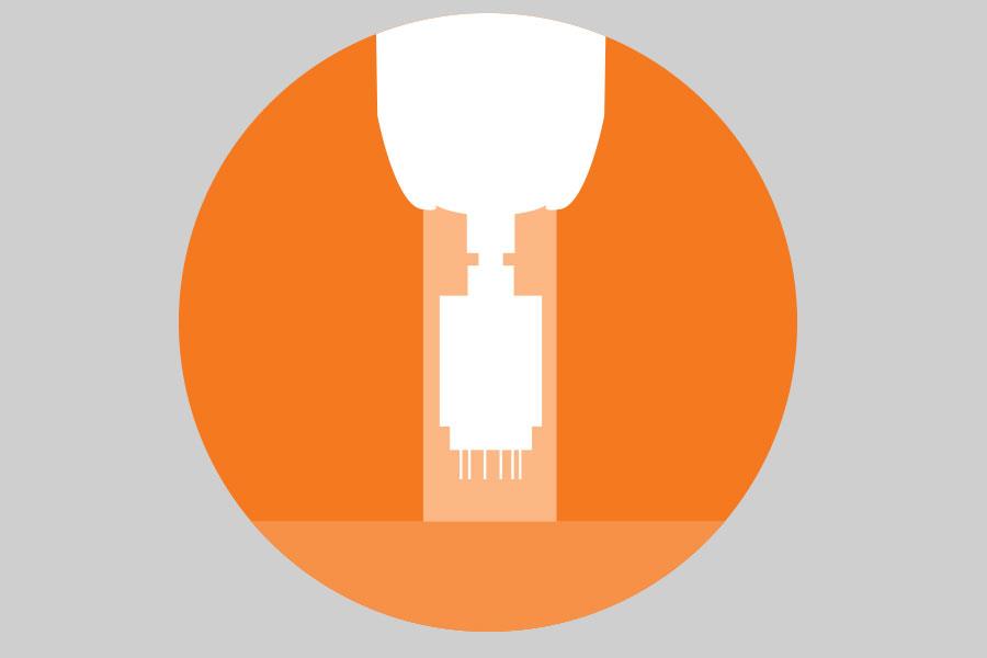 Dermapen for Acne scarring ()